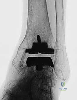 مكونات نظام TNK عن قرب