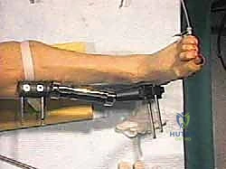 أعراض خشونة الكاحل المتقدمة