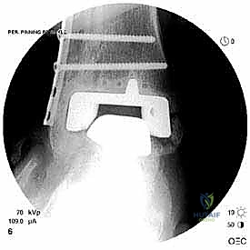 تجهيز الطاقم الطبي