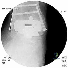 أدوات الجراحة الدقيقة