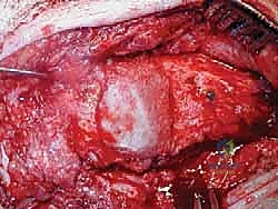 مقارنة صور الأشعة قبل وبعد الفشل