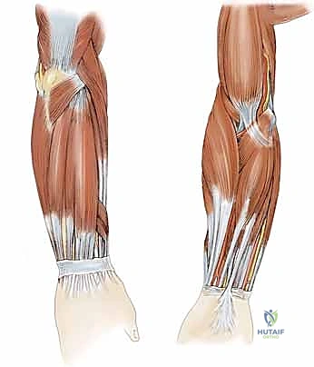 تخطيط الجراحة وتحديد مسارات الأوتار