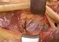 التحضير المسبق لغرفة العمليات المجهزة بأحدث التقنيات