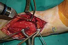 خيارات العلاج التحفظي