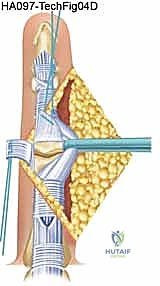 Clinical Image