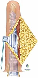 Clinical Image