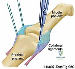 Clinical Image