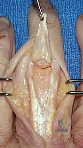 Clinical Image