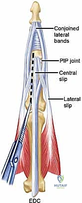 Clinical Image