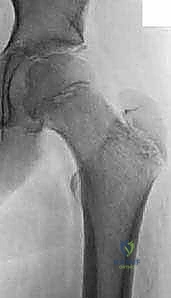 Illustration of richard s davidson - Dr. Mohammed Hutaif