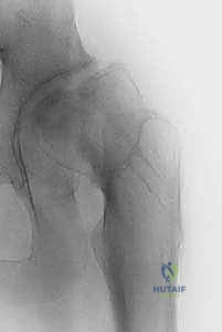 Illustration of richard s davidson - Dr. Mohammed Hutaif