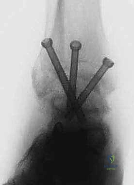 Clinical Image