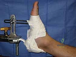 إدخال السلك الدليلي تحت الأشعة