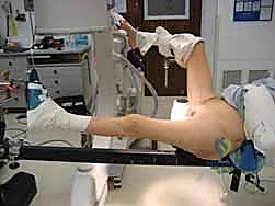 تجهيز أدوات التثبيت الجراحي