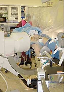 تحديد مسار المسمار الجراحي