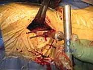 مراجعة التثبيت النهائي تحت الأشعة