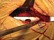 ضبط زاوية التثبيت