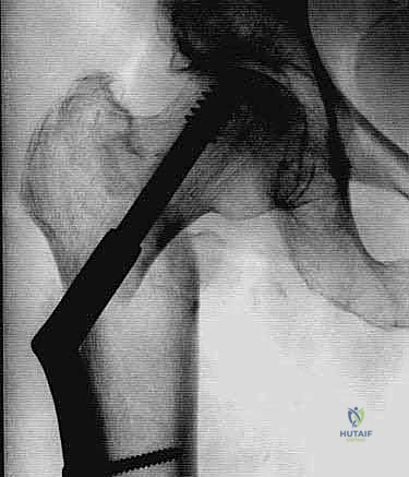 Clinical Image