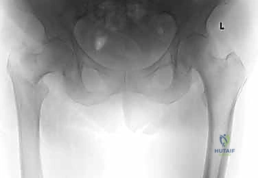 Clinical Image