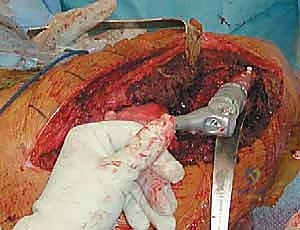 Illustration of danis danis dansis - Dr. Mohammed Hutaif