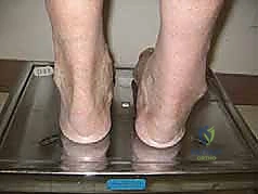 طرق العلاج التحفظي والجراحي للكاحل