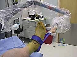 إدخال المنظار الجراحي بدقة 4K