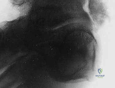 Clinical Image