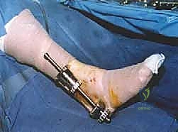 Clinical Image