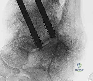 Clinical Image