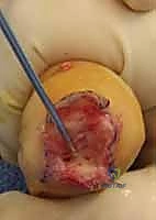 Clinical Image