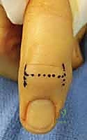 Clinical Image