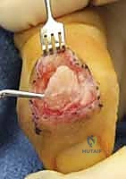Clinical Image
