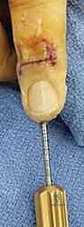 Clinical Image