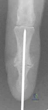 Clinical Image