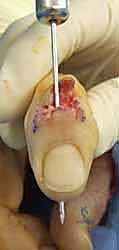 Clinical Image