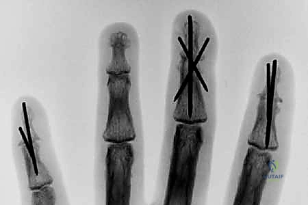Clinical Image