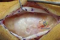 Clinical Image