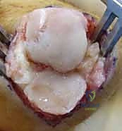Clinical Image