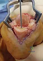 Clinical Image