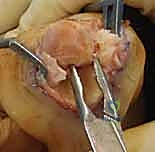 Clinical Image