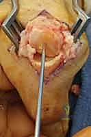 Clinical Image