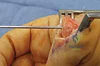Clinical Image