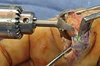 Clinical Image