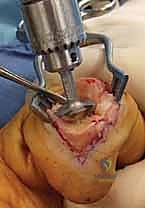Clinical Image
