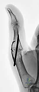 Clinical Image