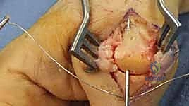 Clinical Image