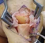 Clinical Image