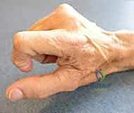 Clinical Image