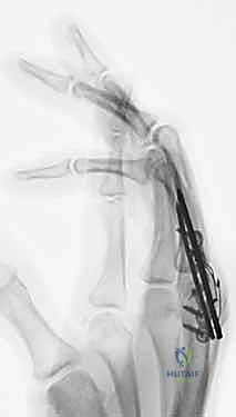 Clinical Image