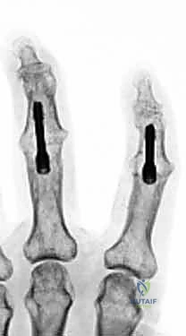 Clinical Image